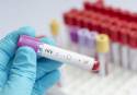 Sanidad insiste en la importancia de realizarse la prueba del VIH para evitar su transmisión