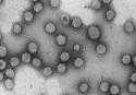 Virus de la familia Coronaviridae (Foto: Luis Enjuanes-CNB-CSIC)