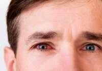 La conjuntivitis alérgica y el ojo seco son las afecciones oculares más comunes en primavera