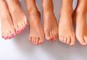 El exceso de sudoración, el dolor de juanetes y el mal olor son tres de las afecciones más comunes de los pies en primavera