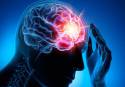 El 75% de los neurólogos que atienden casos de dolores de cabeza suprimieron su actividad presencial durante la pandemia
