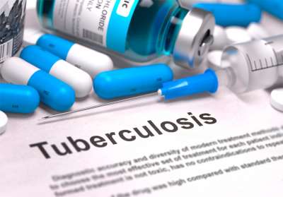 La OMS pide más inversiones para prevenir y tratar la tuberculosis