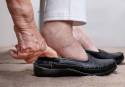 Los podólogos advierten de que, las bajas temperaturas, aumenta la presencia de sabañones en los pies de los mayores