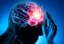 Cada año se diagnostican en España unos 1.200 nuevos casos de encefalitis