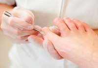 Un 20% de los pacientes que acuden al podólogo sufren uñas encarnadas