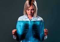 Los síntomas que pueden alertar de un cáncer de pulmón temprano