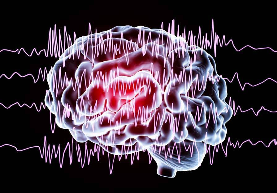 Casi el 30% de los pacientes españoles que padecen epilepsia experimentaron un aumento de la frecuencia de sus crisis debido a la pandemia