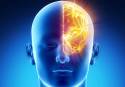 En más del 50% de los casos no se llega a identificar el agente causal de las encefalitis