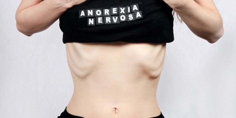 Uno de cada cien adolescentes sufre anorexia nerviosa y cuatro de cada cien bulimia