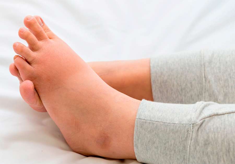 Los podólogos ofrecen nueve consejos para cuidar los pies durante el embarazo