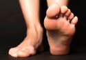 El 40% de las lesiones en el pie diabético se podrían evitar si se trataran de forma precoz