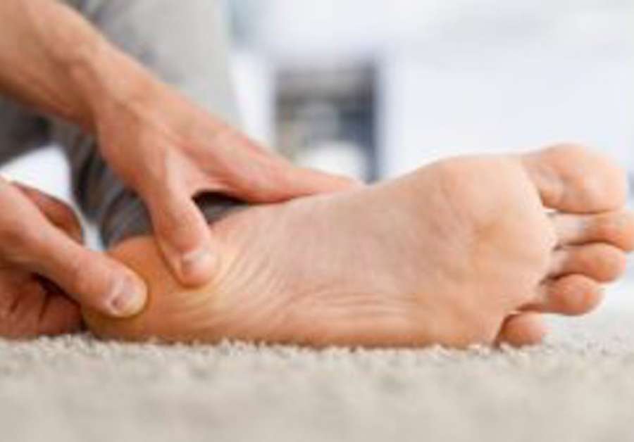 Los podólogos confirman que la fibromatosis plantar afecta más a los pies de los hombres