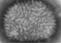 Imagen al microscopio del virus Vaccinia. (Foto: CDC / Cynthia Goldsmith)