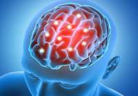 Cada año se diagnostican unos 1.200 casos nuevos de encefalitis en España