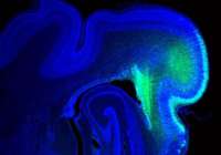 Imagen del cerebro de un hurón (Foto: CSIC-UMH)