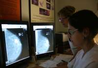 El programa de prevención de cáncer de mama de Sanidad permite detectar cerca de 19.600 cánceres