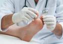 La ‘Piel de Mariposa’ es una de las enfermedades raras que más afecta a la salud de los pies
