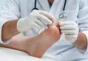 Una de cada 90.000 personas padece ectrodactilia en los pies