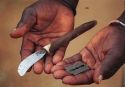 Sanidad detecta un aumento del 20% de casos de mutilación genital